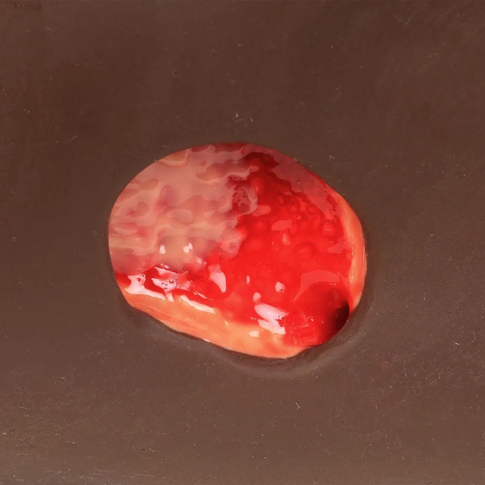 Seymour II - Wound Care Model, Dark